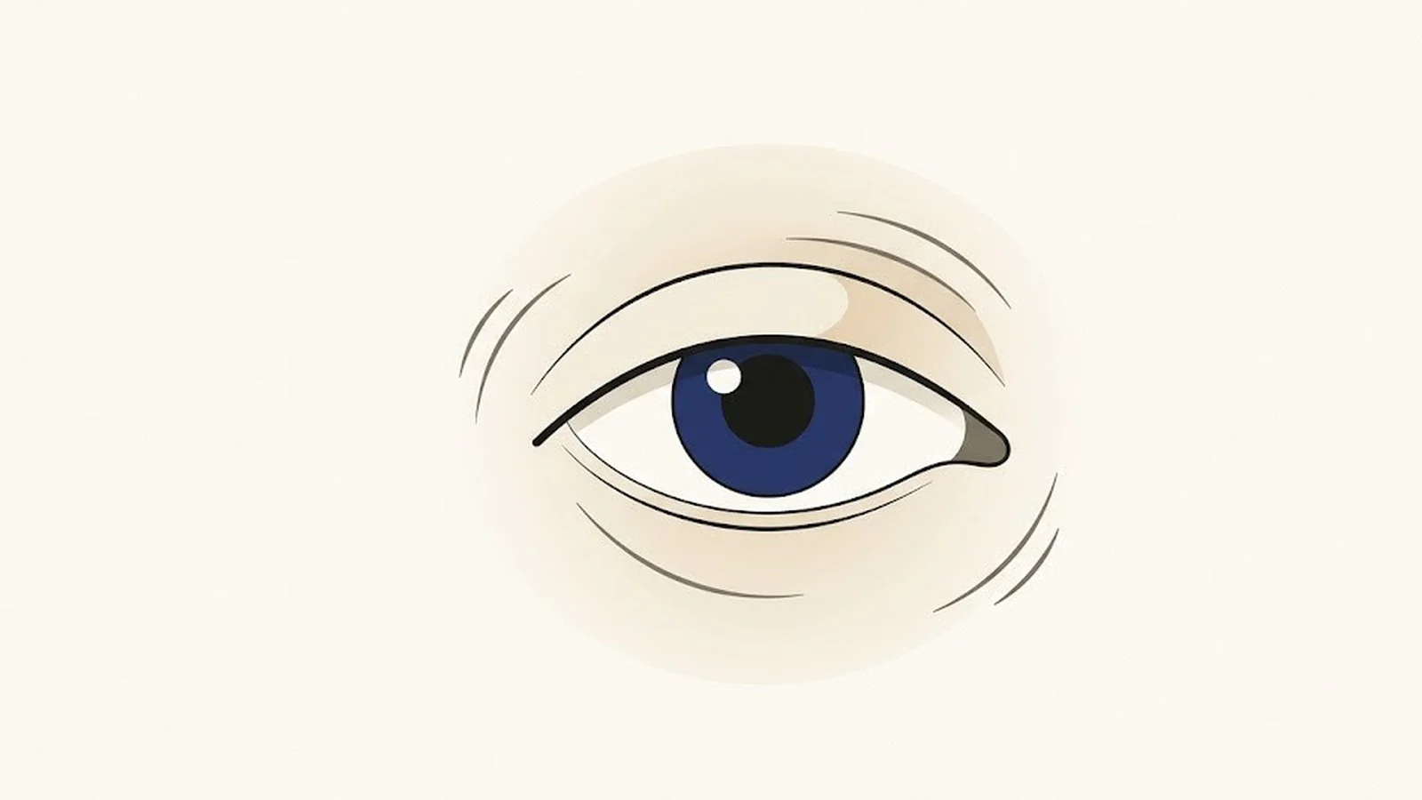 Блефароспазм: почему дёргается и непроизвольно закрывается глаз